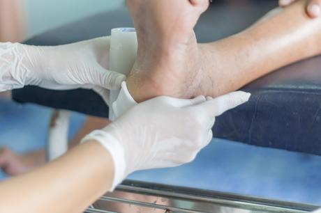 Des semelles réfrigérées peuvent réduire le risque et le développement d’ulcères du pied chez les personnes diabétiques (Visuel AdobeStock_165767373)