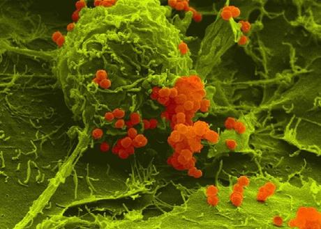 La petite protéine de liaison ProQ garantit que les méningocoques seront capables de réparer leur ADN s'ils sont endommagés et les rend également résistants au stress oxydatif (Visuel Alexandra Schubert-Unkmeir / Université de Wuerzburg) La petite protéine de liaison ProQ garantit que les méningocoques seront capables de réparer leur ADN s'ils sont endommagés et les rend également résistants au stress oxydatif (Visuel Alexandra Schubert-Unkmeir / Université de Wuerzburg)