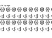 MALADIES RARES phénotypage facial pour détecter chez l’Enfant