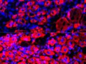 CURE JOUVENCE Diluer plasma pour inverser vieillissement