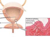 infection urinaire Tout vous devez savoir