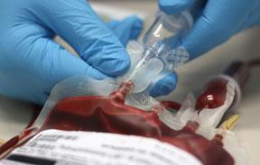#thelancethaematology #COVID-19 #transfusionsanguine Effet de la pandémie COVID-19 sur l’approvisionnement en sang et son utilisation pour les transfusions