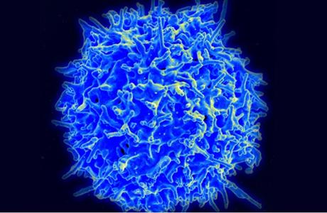 Des cas bénins de COVID-19 peuvent produire une forte réponse des lymphocytes T à mémoire (Visuel NIH) Des cas bénins de COVID-19 peuvent produire une forte réponse des lymphocytes T à mémoire (Visuel NIH)