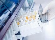 CANCER PEAU simple test d’urine pour surveiller