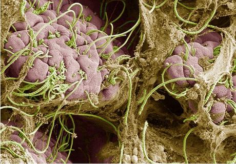 Le stress et le microbiome intestinal -via les bactéries filamenteuses segmentées sur visuel-  jouent un rôle clé dans le déclenchement des crises vaso-occlusives chez les personnes atteintes de drépanocytose (Visuel NYU Grossman School of Medicine)