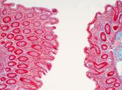 MICROBIOTE L'enzyme révèle maladie intestinale