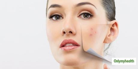 Les bienfaits prometteurs de l'huile de noix pour les soins de la peau expliqués par un dermatologue de renom 26 1599204359 886 Les bienfaits prometteurs de lhuile de noix pour les soins