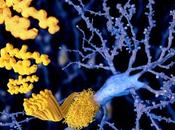 ALZHEIMER Découverte d’une voie surproduction l'amyloïde
