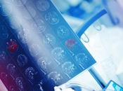 NEURODÉGÉNÉRESCENCE Identifier lésions encore invisibles l'IRM