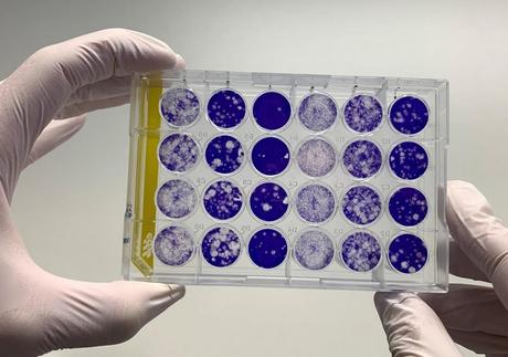 Les anticorps anti-coronavirus durent au moins 3 mois après l'infection à SARS-COV-2 ? (Visuel Fotolia) Les anticorps anti-coronavirus durent au moins 3 mois après l'infection à SARS-COV-2 ? (Visuel Fotolia)