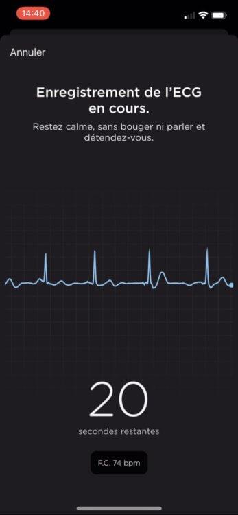 La montre Withings Scanwatch testée de fond en comble