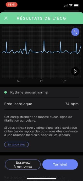 La montre Withings Scanwatch testée de fond en comble