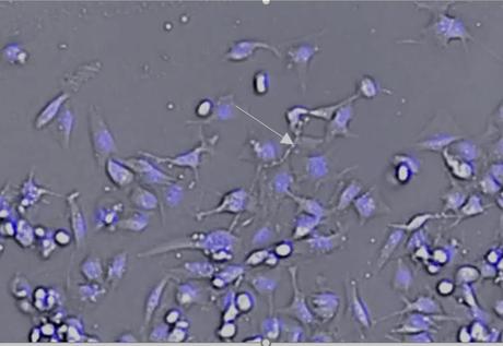 Ces cellules géantes utilisent des filaments cellulaires appelés vimentine pour migrer (PNAS)