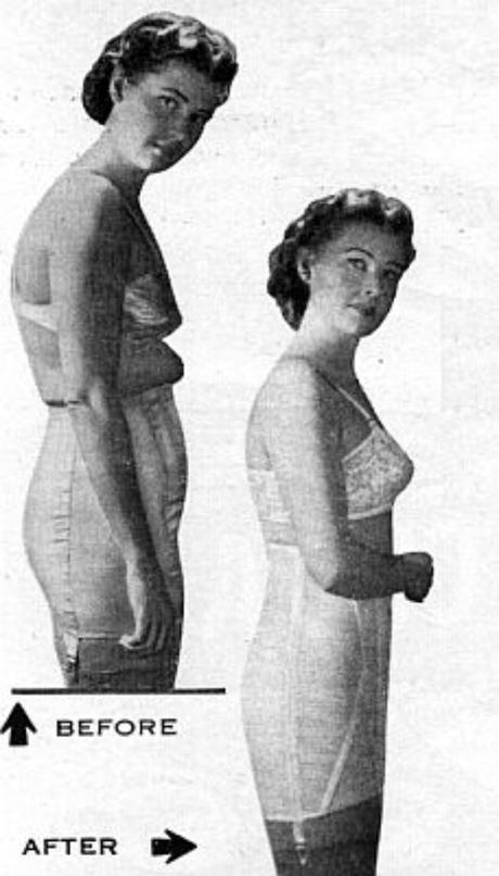 vintage-girdles-corsets-3
