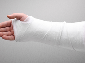 règles traitement orthopédique d’une fracture distale radius