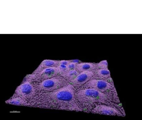Nanoplastiques dans des cellules intestinales de poisson-zèbre (Visuel UAB / CREAF) 