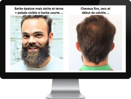 Comment favoriser la pousse de la barbe et ralentir la chute de cheveux avec MADAME LA PRÉSIDENTE ? Comment favoriser la pousse de la barbe et ralentir la chute de cheveux avec MADAME LA PRÉSIDENTE ?