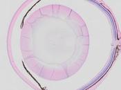MALADIES OCULAIRES DÉGÉNÉRATIVES joker pour protéger vision