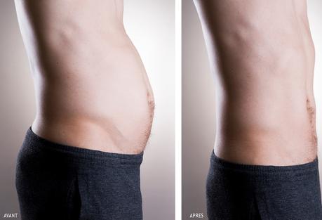 Résultats constatés après plusieurs séances de Cryobar Sculpt Résultats constatés après plusieurs séances de Cryobar Sculpt