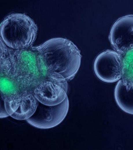 Nouvelles formes de l’Art   19/22-  le Bio.art -Billet n° 436