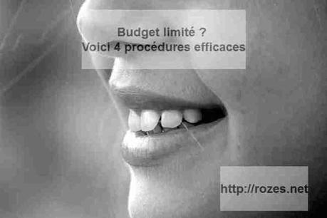 Budget limité ? Voici 4 procédures efficaces Budget limité ? Voici 4 procédures efficaces