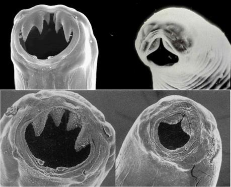 La diversité des crochets qu'emploient les vers ankylostomes (ici Ancylostoma duodenale et Necator americanus) pour s'accrocher à notre paroi intestinale et ponctionner du sang.