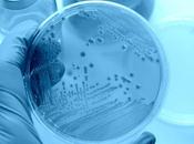 MICROBIOTE changements pourraient déclencher maladie Alzheimer