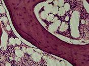 CRISE CARDIAQUE graisses alimentaires font enfler cardiomyocytes aussi