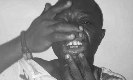 Cameroun – Liberté de presse : Des reporters de Canal 2 tabassés à Yaoundé