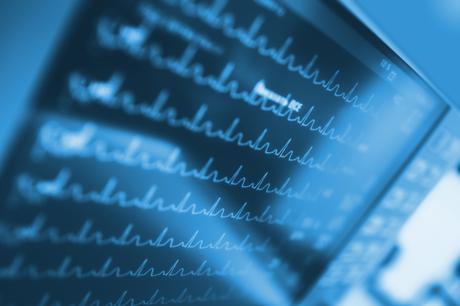 Chez certains, 1 ou 2 verres d'alcool peuvent entraîner un effet immédiat de fibrillation auriculaire (FA) ou de troubles du rythme cardiaque (Visuel Adobe Stock 106779070) Chez certains, 1 ou 2 verres d'alcool peuvent entraîner un effet immédiat de fibrillation auriculaire (FA) ou de troubles du rythme cardiaque (Visuel Adobe Stock 106779070)