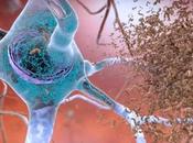INTESTIN-CERVEAU lien entre microbiote neurodégénérescence