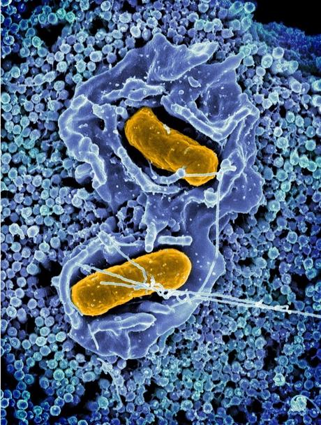 La tentative du système immunitaire d'éliminer les bactéries Salmonella du tractus gastro-intestinal facilite plutôt la colonisation du tractus intestinal et l'excrétion fécale (Visuel NIAID).