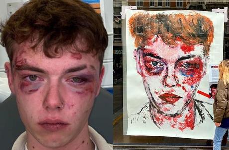 Un artiste utilise ses poings pour peindre un portrait percutant d’un adolescent bisexuel battu pour “ne pas être hétéro”