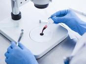 CANCER VESSIE test sanguin détecte maladie résiduelle