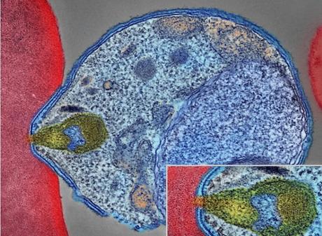 Le moustique injecte les parasites sous forme de sporozoïtes dans la peau et la circulation sanguine (Visuel montrant un parasite du paludisme se fixant à un globule rouge humain) (Visuel NIAID) Le moustique injecte les parasites sous forme de sporozoïtes dans la peau et la circulation sanguine (Visuel montrant un parasite du paludisme se fixant à un globule rouge humain) (Visuel NIAID)