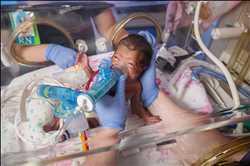 Analyse SWOT du marché mondial des ventilateurs NICU, indicateurs clés, prévisions 2027 : Vyaire Medical, ACUTRONIC, Hamilton Medical Analyse SWOT du marché mondial des ventilateurs NICU, indicateurs clés, prévisions 2027 : Vyaire Medical, ACUTRONIC, Hamilton Medical