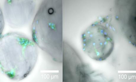 Des gouttes de gel de la taille d'un micromètre peuvent fournir l'architecture extracellulaire nécessaire, en médecine régénérative, à la croissance et à la prolifération des cellules au cours de la cicatrisation (Visuel 2021 KAUST ; Gustavo Ramírez Calderón.)