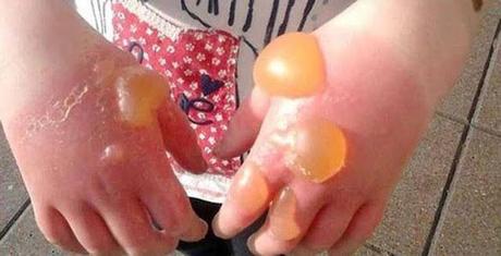 Divers Marcheurs Randonneurs "Prudence"