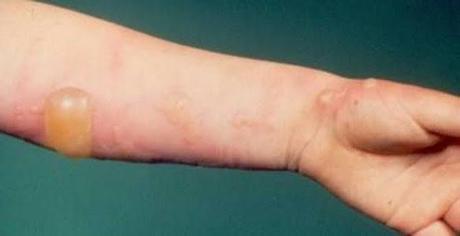 Divers Marcheurs Randonneurs "Prudence"