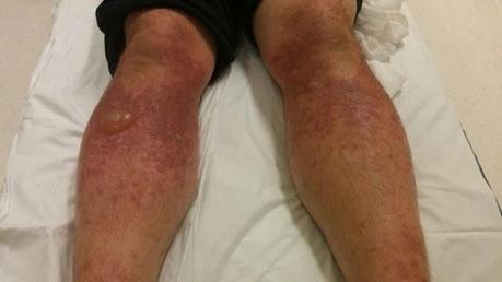 Divers Marcheurs Randonneurs "Prudence"