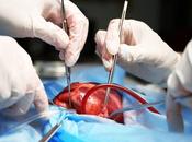 CHIRURGIE CARDIAQUE L’IA pour prioriser interventions