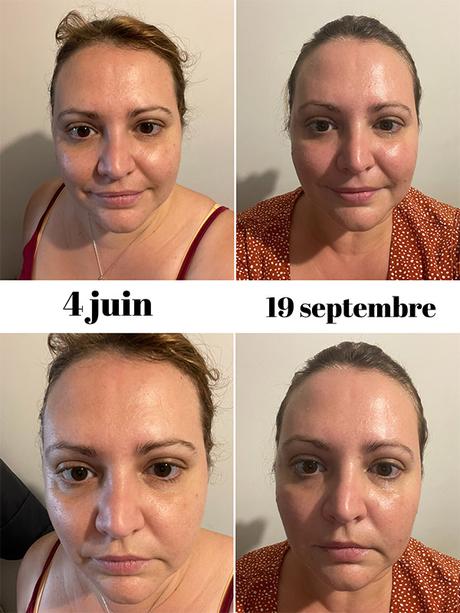 ageLOC Boost : Mon nouvel appareil jeunesse ageLOC Boost : Mon nouvel appareil jeunesse