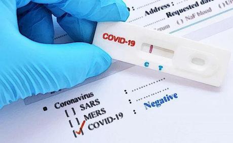 Covid-19 : est-il pertinent de faire payer les tests de dépistage ?