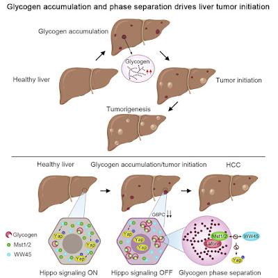 #Cell #glycogène #foie #tumeurhépatique L'accumulation de glycogène et la séparation de phases entraînent l'initiation d'une tumeur hépatique