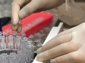 COVID-19 torquetenovirus, marqueur salivaire pronostic