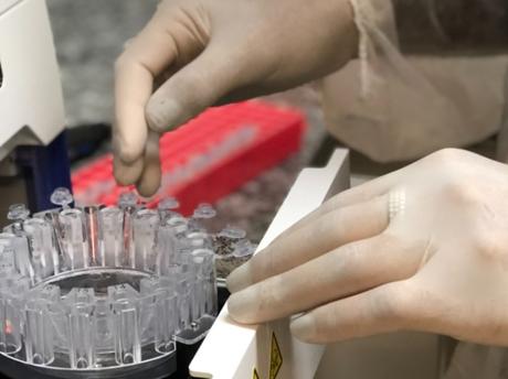 Les niveaux d'un virus courant, le torquetenovirus semblent marquer la maladie et sa sévérité dans la salive (Visuel IMT-USP) Les niveaux d'un virus courant, le torquetenovirus semblent marquer la maladie et sa sévérité dans la salive (Visuel IMT-USP)