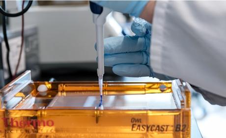 Ce cas illustre la puissance chez certains sujets contrôleurs d’élite, du système immunitaire inné qui via les cellules T tueuses, parvient à contrôler la réplication virale sans avoir besoin de médicaments (Visuel NIH)