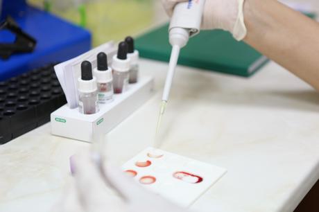 La leptine, une hormone impliquée dans la satiété, produite par les cellules adipeuses, semble annuler les effets de la thérapie bloquant les œstrogènes, le tamoxifène, un médicament couramment utilisé pour traiter et prévenir les cancers du sein (Visuel Adobe Stock 32749227) La leptine, une hormone impliquée dans la satiété, produite par les cellules adipeuses, semble annuler les effets de la thérapie bloquant les œstrogènes, le tamoxifène, un médicament couramment utilisé pour traiter et prévenir les cancers du sein (Visuel Adobe Stock 32749227)