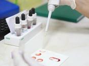 OBÉSITÉ CANCER Leptine contre tamoxifène