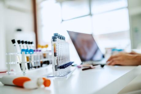 Il s'agit de bloquer un récepteur impliqué et nécessaire dans la croissance du cancer (Visuel Adobe Stock 306513975) Il s'agit de bloquer un récepteur impliqué et nécessaire dans la croissance du cancer (Visuel Adobe Stock 306513975).